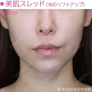 東京形成美容外科 船橋院 弓削田　浩主医師の症例