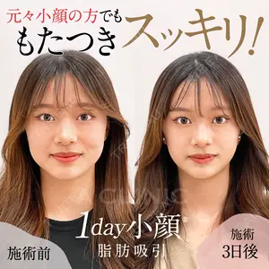 A CLINIC（エークリニック） 仙台院 中村 光宏医師の症例