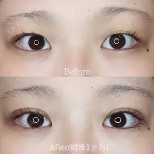ハナビューティークリニックの症例