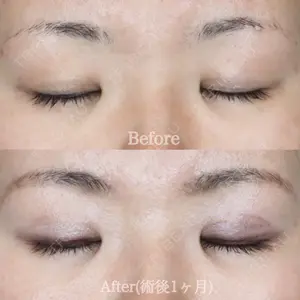 ハナビューティークリニック 厚田 幸子医師の症例