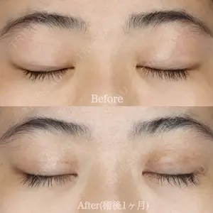 ハナビューティークリニック 厚田 幸子医師の症例