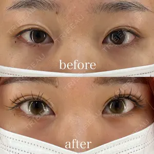 HAAB×DREAM BEAUTY CLINIC 東京本院 田中 優太医師の症例