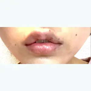 ルラ美容クリニック 大阪院の平田 一記医師口コミ
