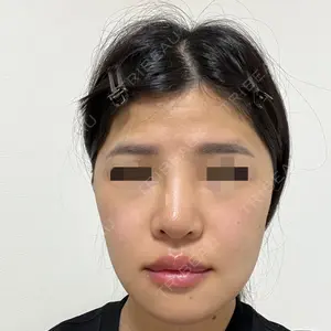 ヒューマン美容整形外科口コミ