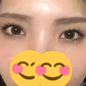 200 days after image