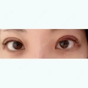 秋葉原美容クリニック口コミ