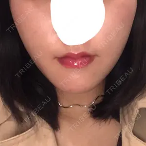 100 days after image