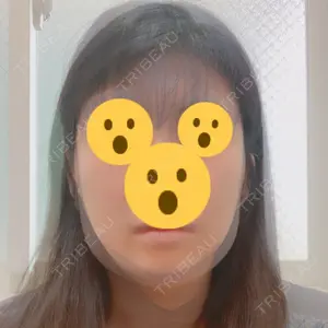 64 days after image