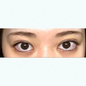 湘南美容クリニック 湘南美容クリニック 池袋東口院口コミ