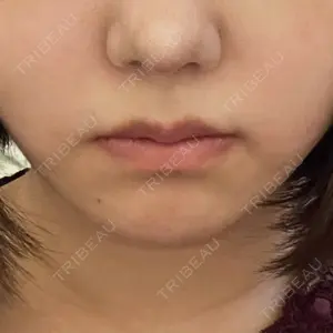 渋谷美容外科クリニック 渋谷美容外科クリニック 渋谷院口コミ