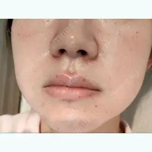 口コミ