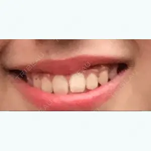 23 days after image