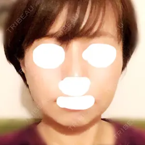 50 days after image