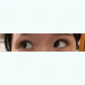 湘南美容クリニック 湘南美容クリニック 池袋東口院口コミ