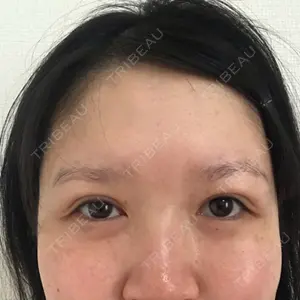 28 days after image