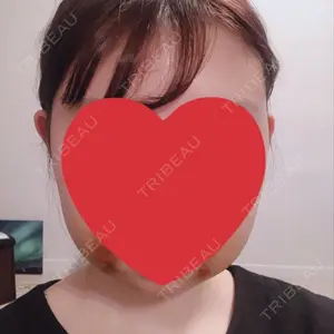 6 days after image