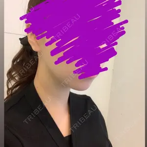 1 days after image