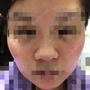 10 days after image