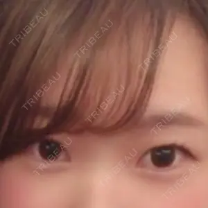 65 days after image