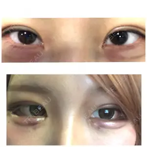 8 days after image