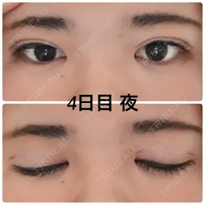 4 days after image