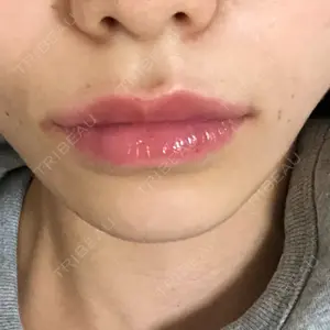 2 days after image