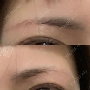 100 days after image