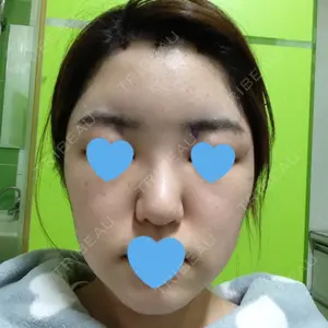 口コミ
