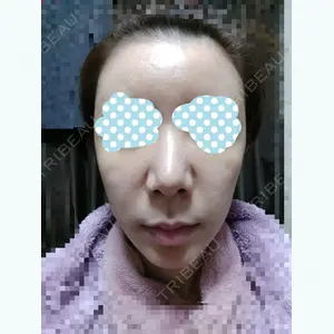 31 days after image