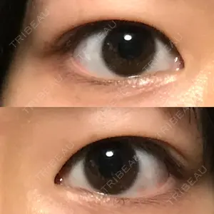 6 days after image