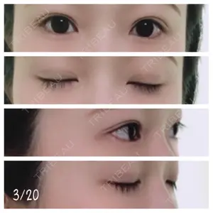 51 days after image