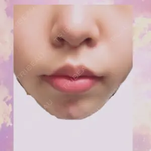 8 days after image