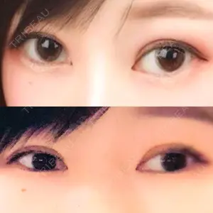 40 days after image