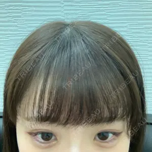 0 days after image
