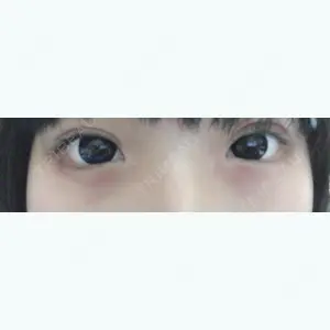 10 days after image