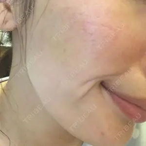 16 days after image