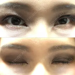 11 days after image