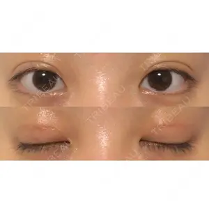 73 days after image