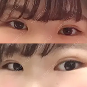 182 days after image