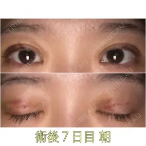 7 days after image