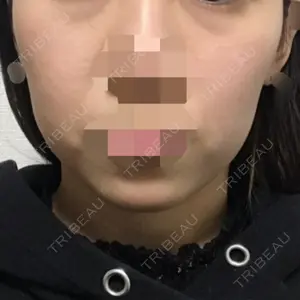 30 days after image