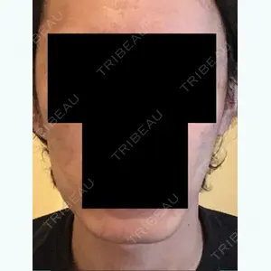 3 days after image
