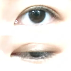14 days after image