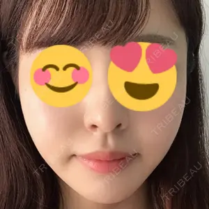 40 days after image