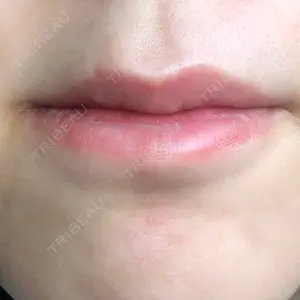 19 days after image