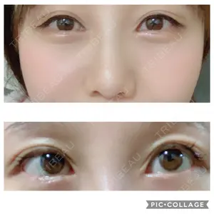 146 days after image
