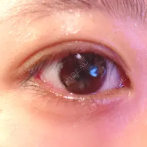14 days after image