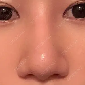 33 days after image
