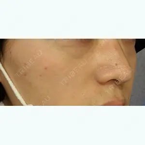 20 days after image