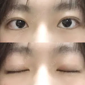 28 days after image